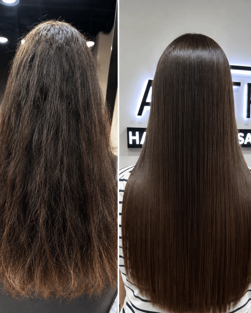 Nanoplastia Before After Business Bay Dubai