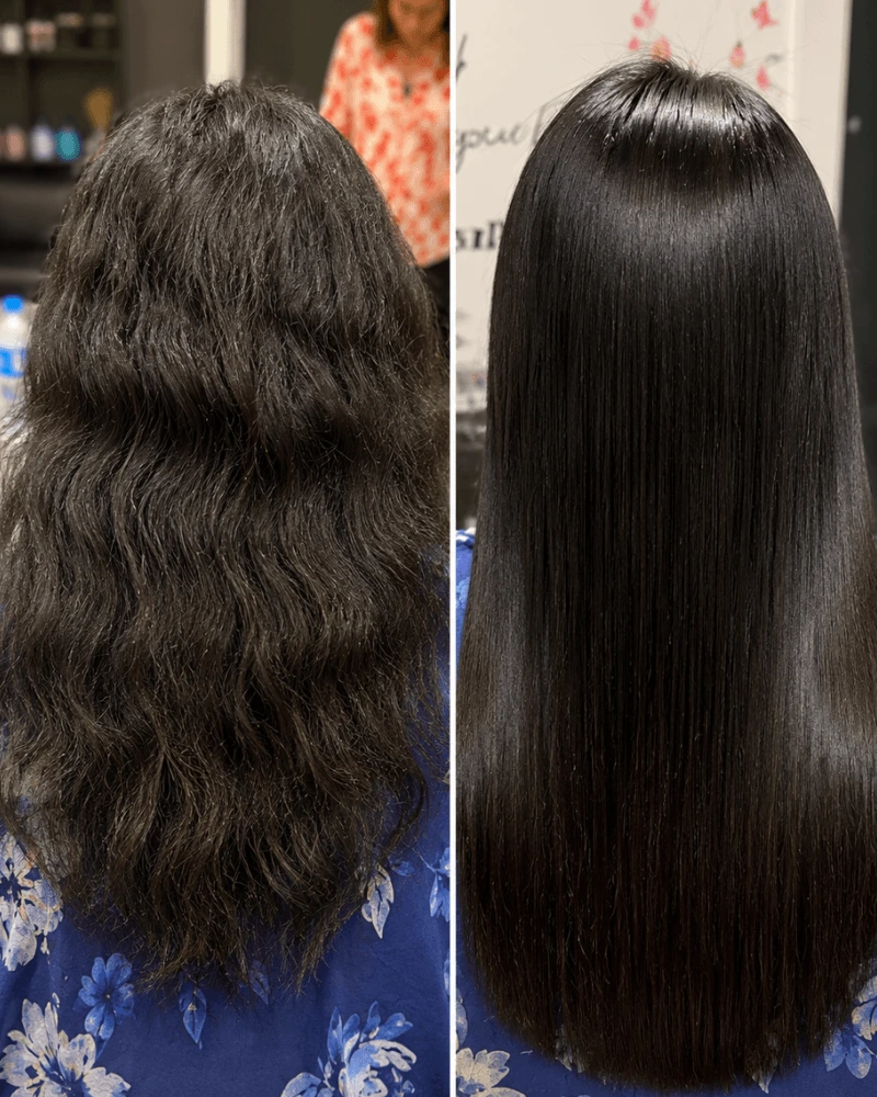 Nanoplastia Before After Business Bay Dubai